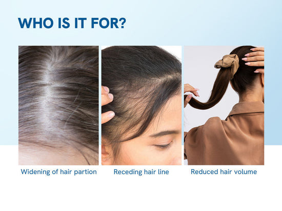 Be Bodywise 3% Rosemary Hair Growth Serum Roll-On