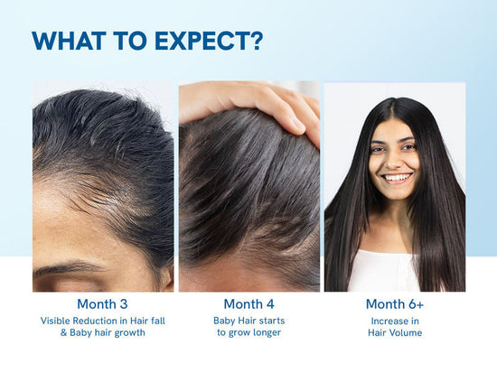 Be Bodywise 3% Rosemary Hair Growth Serum Roll-On