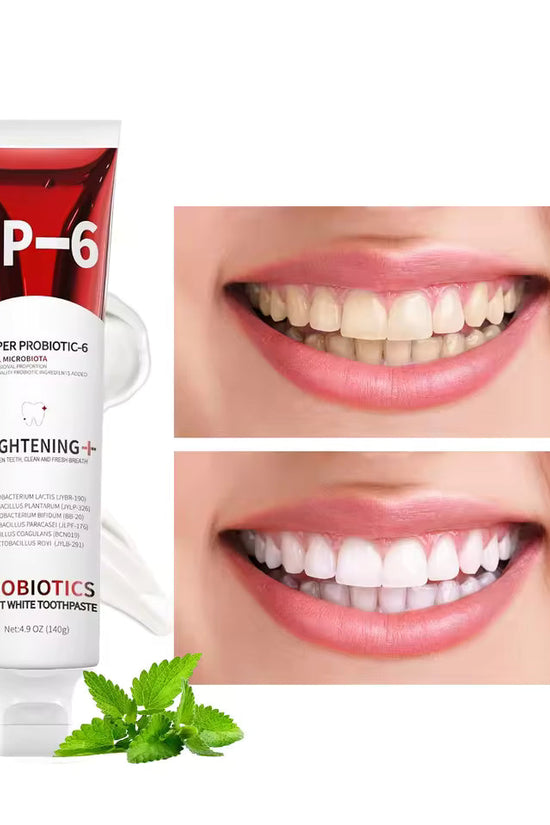 Oral Care Probiotic Whitening Toothpaste