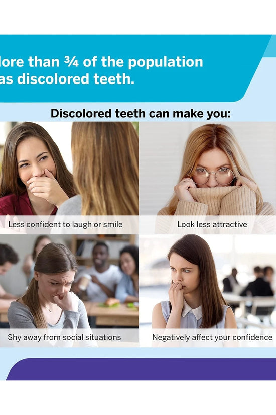 Luxsmile Teeth Whitening Kit