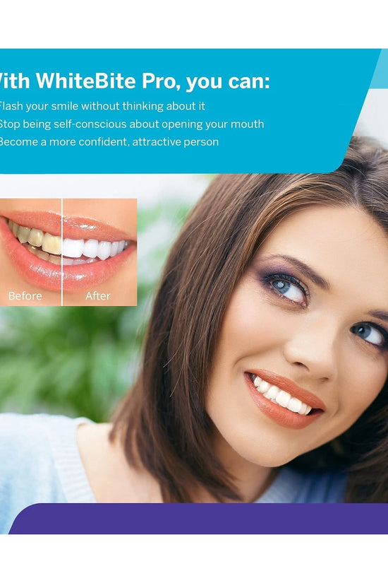 Luxsmile Teeth Whitening Kit