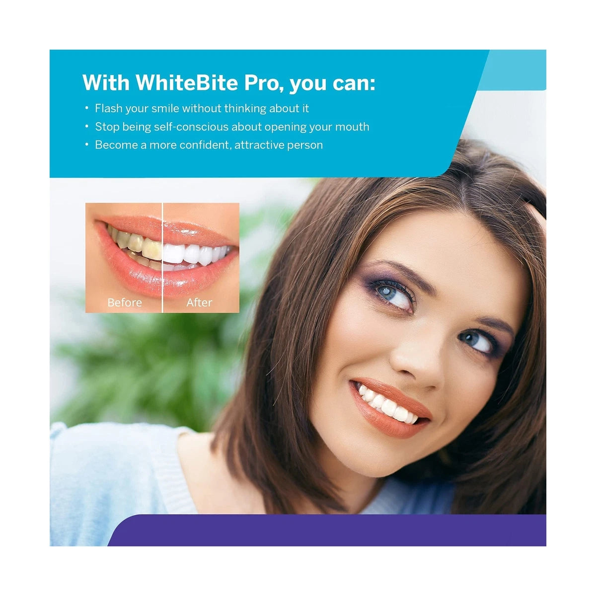 Luxsmile Teeth Whitening Kit